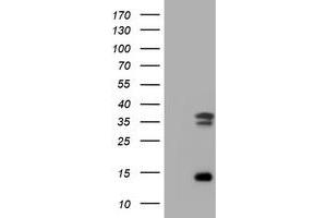 Image no. 2 for anti-Thymidylate Synthetase (TYMS) antibody (ABIN1501593) (TYMS 抗体)