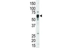 Western Blotting (WB) image for anti-Nuclear Receptor Subfamily 4, Group A, Member 3 (NR4A3) antibody (ABIN3003456) (NR4A3 抗体)