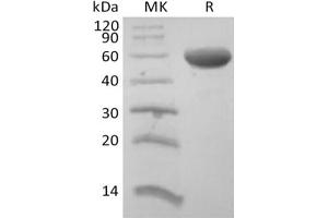 Western Blotting (WB) image for CD8b Molecule (CD8B) protein (Fc Tag) (ABIN7319847) (CD8B Protein (Fc Tag))