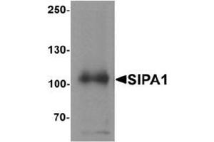 Western blot analysis of SIPA1 in human brain tissue lysate with SIPA1 antibody at 1 μg/mL.