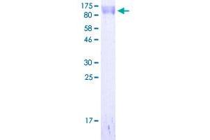 Image no. 2 for Melanoma Cell Adhesion Molecule (MCAM) (AA 24-646) protein (His-DYKDDDDK-Strep II Tag) (ABIN2752854)