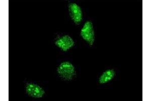 Immunofluorescence of monoclonal antibody to GBX2 on HeLa cell. (GBX2 抗体  (AA 114-182))