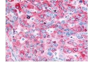 Immunohistochemistry (IHC) image for anti-Epidermal Growth Factor Receptor (EGFR) (C-Term) antibody (ABIN285758) (EGFR 抗体  (C-Term))