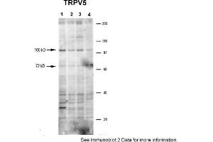 Western Blotting (WB) image for anti-Transient Receptor Potential Cation Channel, Subfamily V, Member 5 (TRPV5) (N-Term) antibody (ABIN2783755)
