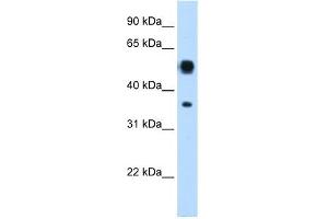 WB Suggested Anti-ASL Antibody Titration:  0. (ASL 抗体  (N-Term))
