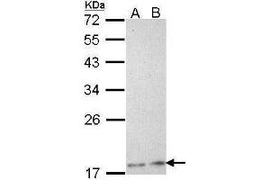WB Image Sample (30 ug of whole cell lysate) A: H1299 B: Hela 12% SDS PAGE antibody diluted at 1:1000 (PLA2G12A 抗体)