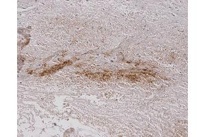 Immunohistochemistry analysis using Mouse Anti-Alginate Monoclonal Antibody, Clone 4B10-1C5 . (Alginate 抗体 (FITC))