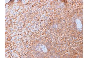 Formalin-fixed, paraffin-embedded human Spleen stained with CD40L-Monospecific Mouse Monoclonal Antibody (CD40LG/2761).