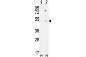 Western Blotting (WB) image for anti-Paraoxonase 1 (PON1) antibody (ABIN2995778) (PON1 抗体)
