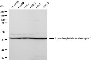 Western blotting analysis using Lysophosphatidic acid receptor 1 antibody (ABIN7799304).