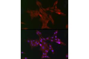 Immunohistochemistry of paraffin-embedded mouse stomach using DC Rabbit pAb (ABIN6132184, ABIN6139432, ABIN6139434 and ABIN6222532) at dilution of 1:150 (40x lens). (DCAF7 抗体  (AA 1-342))