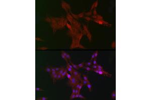 Immunohistochemistry of paraffin-embedded mouse stomach using DC Rabbit pAb (ABIN6132184, ABIN6139432, ABIN6139434 and ABIN6222532) at dilution of 1:150 (40x lens). (DCAF7 抗体  (AA 1-342))