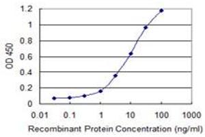 Detection limit for recombinant GST tagged DYX1C1 is 0. (DYX1C1 抗体  (AA 336-420))