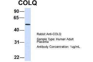 Host:  Rabbit  Target Name:  COLQ  Sample Type:  Human Adult Placenta  Antibody Dilution:  1. (COLQ 抗体  (N-Term))