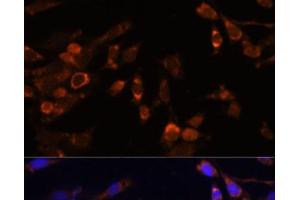 Immunofluorescence analysis of NIH-3T3 cells using PSMB7 Polyclonal Antibody at dilution of 1:100 (40x lens).