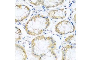 Immunohistochemistry of paraffin-embedded human stomach using PCDHA12 antibody. (PCDHA12 抗体  (AA 713-792))