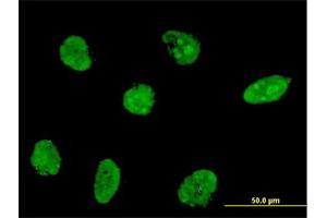 Immunofluorescence of monoclonal antibody to NHLH2 on HeLa cell. (NHLH2 抗体  (AA 36-135))