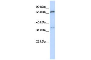 Western Blotting (WB) image for anti-Tripartite Motif Containing 23 (TRIM23) antibody (ABIN2457927) (TRIM23 抗体)
