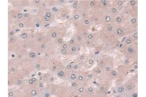 Immunohistochemistry (IHC) image for anti-Coxsackie Virus and Adenovirus Receptor (CXADR) (AA 20-229) antibody (ABIN7441556)
