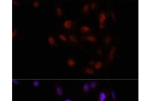 Immunofluorescence analysis of U2OS cells using HOXA2 Polyclonal Antibody at dilution of 1:100. (HOXA2 抗体)