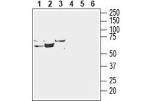 Western blot analysis of rat liver lysate (lanes 1 and 4), mouse liver lysate (lanes 2 and 5) and rat kidney membranes (lanes 3 and 6): - 1-3. (SLC29A3 抗体  (Intracellular, N-Term))