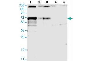 Western blot analysis of Lane 1: RT-4, Lane 2: U-251 MG, Lane 3: Human Plasma, Lane 4: Liver, Lane 5: Tonsil with LTV1 polyclonal antibody  at 1:250-1:500 dilution. (LTV1 抗体)