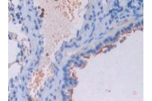 Detection of UCN3 in Mouse Lung Tissue using Polyclonal Antibody to Urocortin 3 (UCN3) (UCN3 抗体  (AA 24-149))