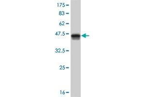 Western Blot detection against Immunogen (37. (HOXB1 抗体  (AA 101-210))