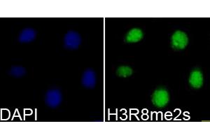 Immunofluorescence analysis of 293T cells using Symmetric DiMethyl-Histone H3-R8 antibody (ABIN3016056, ABIN3016057, ABIN3016058, ABIN1680222 and ABIN6219535). (Histone 3 抗体  (H3R8me2))