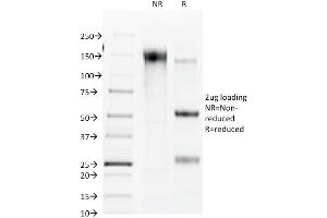SDS-PAGE Analysis Purified Connexin 32 Mouse Monoclonal Antibody (R5.