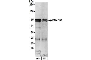 anti-F-Box Protein 31 (FBXO31) (AA 489-539) antibody