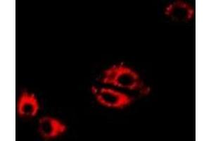 Immunofluorescent analysis of LTA4H staining in Hela cells. (LTA4H 抗体)