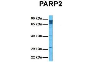 Host:  Rabbit  Target Name:  P Sample Tissue:  Human Hela  Antibody Dilution:  1. (PARP2 抗体  (Middle Region))