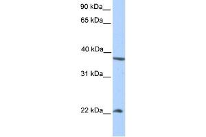 WB Suggested Anti-NEK7 Antibody Titration:  0. (NEK7 抗体  (N-Term))