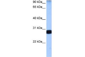 WB Suggested Anti-STAU1 Antibody Titration:  0. (STAU1/Staufen 抗体  (N-Term))