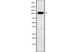 Western blot analysis of ATP2C2 using LOVO whole cell lysates (ATP2C2 抗体  (Internal Region))