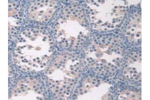 IHC-P analysis of Mouse Testis Tissue, with DAB staining.