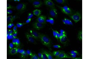 Immunofluorescent staining of SK-N-SH cells (right). (PRKAR2B 抗体  (AA 1-418))