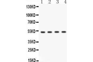 Western blot analysis of BDKRB2 expression in HELA whole cell lysates ( Lane 1), HEPG2 whole cell lysates ( Lane 2), MCF-7 whole cell lysates ( Lane 3) and A549 whole cell lysates ( Lane 4). (BDKRB2 抗体  (C-Term))