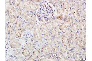 Immunohistochemistry (Paraffin-embedded Sections) (IHC (p)) image for anti-Fc Fragment of IgA, Receptor For (FCAR) (AA 131-230) antibody (ABIN718466)