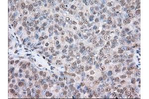Immunohistochemistry (IHC) image for anti-Transforming, Acidic Coiled-Coil Containing Protein 3 (TACC3) antibody (ABIN1498097) (TACC3 抗体)