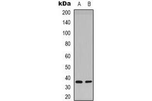 Western blot analysis of Syntaxin 1A (pS14) expression in Hela (A), mouse brain (B) whole cell lysates. (STX1A 抗体  (N-Term, pSer14))