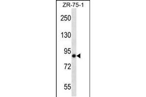 Western blot analysis in ZR-75-1 cell line lysates (35ug/lane). (LRRN4 抗体  (C-Term))