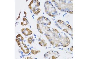 Immunohistochemistry of paraffin-embedded human stomach using N antibody (ABIN6129932, ABIN6144318, ABIN6144319 and ABIN6222781) at dilution of 1:100 (40x lens). (NAA10 抗体  (AA 161-235))