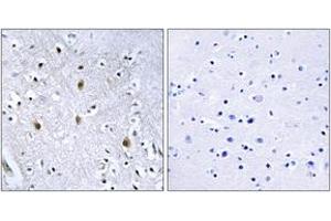 Immunohistochemistry (IHC) image for anti-Insulin Receptor Substrate 1 (IRS1) (AA 605-654) antibody (ABIN2889012) (IRS1 抗体  (AA 605-654))
