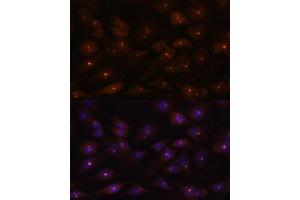 Immunofluorescence analysis of C6 cells using RNA antibody (ABIN7269981) at dilution of 1:100. (RNASEH2A 抗体  (AA 1-299))
