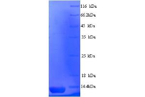 SDS-PAGE (SDS) image for Alopecia, Androgenetic, 2 (AGA2) (AA 19-87) protein (His tag) (ABIN5714098)