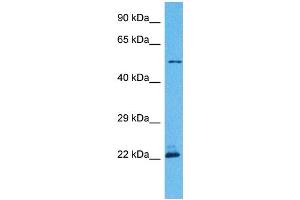 Western Blotting (WB) image for anti-Patatin-Like phospholipase Domain Containing 3 (PNPLA3) (C-Term) antibody (ABIN2783569)