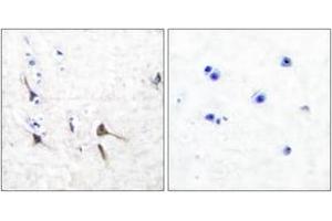 Immunohistochemistry analysis of paraffin-embedded human brain tissue, using Potassium Channel Kv3. (Kv3.2b Potassium Channel 抗体  (AA 589-638))