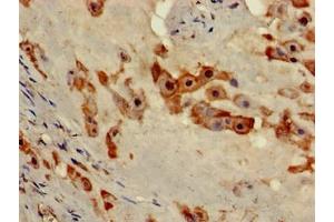 Immunohistochemistry (IHC) image for anti-RNA-Binding Protein NOB1 (NOB1) (AA 103-229) antibody (ABIN7168384)